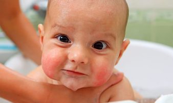 היגיינה וניקיון יומי לתינוקות | صحة الأطفال ونظافتهم اليومية